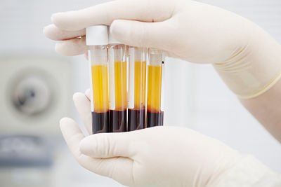 Regenerative Medicine Therapy